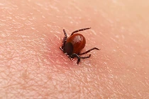 Người phụ nữ 69 tuổi nguy kịch tính mạng vì bị mò đốt