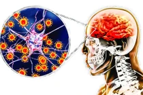 Bệnh viêm não Nhật Bản lây truyền qua đường nào?