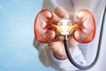 Tự ý bỏ thuốc điều trị tim, người đàn ông bị nhồi máu thận