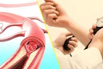Thói quen xấu hằng ngày có thể khiến huyết áp tăng "vù vù"