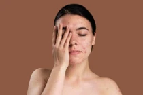 "Điểm mặt" 5 tác hại tiềm ẩn của kem chống nắng nếu dùng sai cách