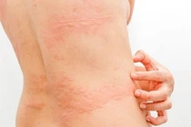 Dấu hiệu cảnh báo cơ thể đang "kêu cứu" cần được thanh lọc