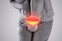 Trót đi "bóc bánh trả tiền", người đàn ông mắc bệnh kín nguy hiểm