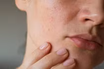 Vì sao bổ sung collagen thường xuyên da vẫn 'xuống cấp không phanh'?