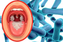 Các biện pháp phòng chống bệnh bạch hầu