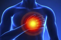 Đang chơi cầu lông, người đàn ông đột ngột ngừng tim