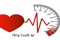 Hạ kali máu, tăng huyết áp tái diễn... đi khám phát hiện hội chứng Conn