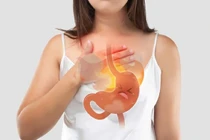 Gợi ý 2 tư thế nằm ngủ phù hợp cho người bị trào ngược dạ dày