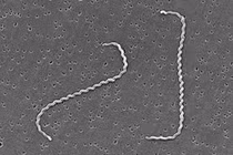 Suýt mất mạng do nhiễm Leptospira - hiểm hoạ từ chuột, ai có nguy cơ mắc?