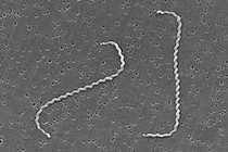 Suýt mất mạng do nhiễm Leptospira - hiểm hoạ từ chuột, ai có nguy cơ mắc?