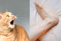 Người phụ nữ tử vong sau 6 tháng bị mèo cào vào chân