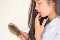 Top 7 thực phẩm giàu dinh dưỡng giúp giảm rụng tóc, nuôi dưỡng tóc dày dặn