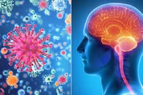 Bệnh viêm màng não mô cầu có lây không?