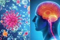 Bệnh viêm màng não mô cầu có lây không?