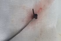 Coi chừng đỉa, vắt chui vào mũi, tai khi tắm sông, suối