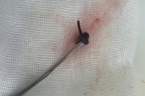 Coi chừng đỉa, vắt chui vào mũi, tai khi tắm sông, suối