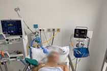 Người đàn ông bị đinh sắt 5cm đâm xuyên thủng xương sọ