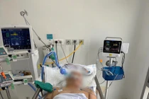 Người đàn ông bị đinh sắt 5cm đâm xuyên thủng xương sọ