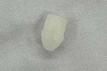 Gắp dị vật đầu bút trong đường thở bé trai 6 tuổi