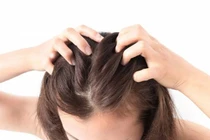 Vì sao nên tẩy tế bào chết cho da đầu?