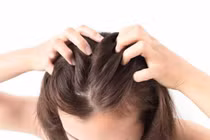 Vì sao nên tẩy tế bào chết cho da đầu?