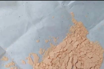 Chữa nấm miệng bằng "thuốc cam", bé trai 2 tuổi nguy kịch