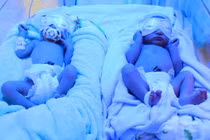 Cứu sống cặp song sinh non tháng suy hô hấp, nhiễm trùng sơ sinh