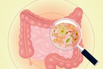 Dấu hiệu cảnh báo đường ruột cực "bẩn", cần cải thiện ngay