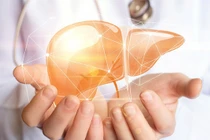 Thói quen đơn giản giúp lá gan khỏe mạnh