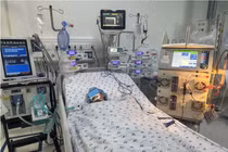 Bị ong vò vẽ đốt 52 vết, bé gái 11 tuổi tổn thương đa cơ quan