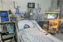 Bị ong vò vẽ đốt 52 vết, bé gái 11 tuổi tổn thương đa cơ quan