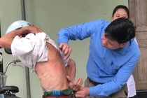 Thanh Hoá: Hàng loạt người "bỗng dưng" bị ngứa kéo dài không rõ nguyên nhân