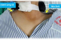 Hệ lụy của việc tự tiêm thuốc ở nhà