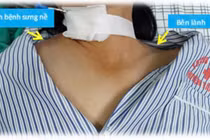 Hệ lụy của việc tự tiêm thuốc ở nhà