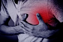 Thói quen xấu khiến người trẻ dễ bị nhồi máu cơ tim