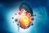 Dấu hiệu cảnh báo có thể bạn đã mắc bệnh thận, cần đi khám ngay