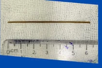 Hiểm họa khôn lường từ thói quen ngậm tăm tre