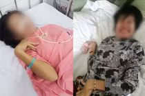 Mắc bệnh Wilson hiếm gặp, cô gái bị chẩn đoán tâm thần phân liệt