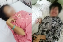 Mắc bệnh Wilson hiếm gặp, cô gái bị chẩn đoán tâm thần phân liệt