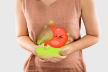 Bỏ túi 6 cách hỗ trợ giảm đầy hơi, chướng bụng hiệu quả tại nhà