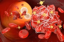 Thói quen xấu làm tăng nguy cơ hình thành cục máu đông