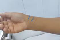 Cảnh báo đề phòng rắn độc tấn công vào mùa hè