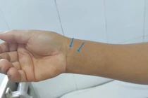 Cảnh báo đề phòng rắn độc tấn công vào mùa hè