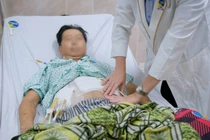 Lạm dụng thuốc giảm đau, người đàn ông bị thủng dạ dày gây sốc nhiễm trùng