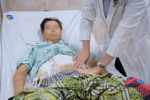 Lạm dụng thuốc giảm đau, người đàn ông bị thủng dạ dày gây sốc nhiễm trùng