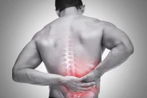 Giảm đau thắt lưng bằng 6 bài tập đơn giản tại nhà