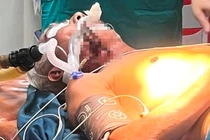 Hà Tĩnh: Cứu cụ ông bị thanh sắt đâm xuyên cổ