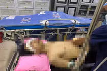 Nam sinh bị dập nát bàn tay, tổn thương 2 mắt sau tiếng nổ lớn