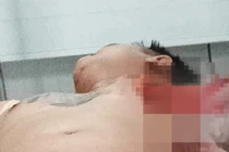 Đang ngồi nhậu cùng bạn, nam thanh niên bị chém trọng thương