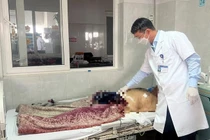 Người đàn ông tự cắt lìa dương vật vì đi tiểu khó khăn